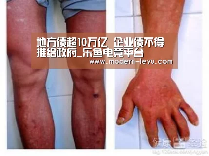 地方债超10万亿 企业债不得推给政府_乐鱼电竞平台(图1) 乐鱼电竞leyu